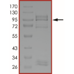 EGFR (d746-750 C775S T790M L858R), Active
